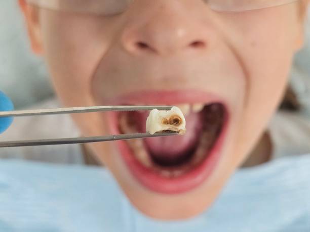 Best Walk-In Emergency Dental Services in Norco, LA
